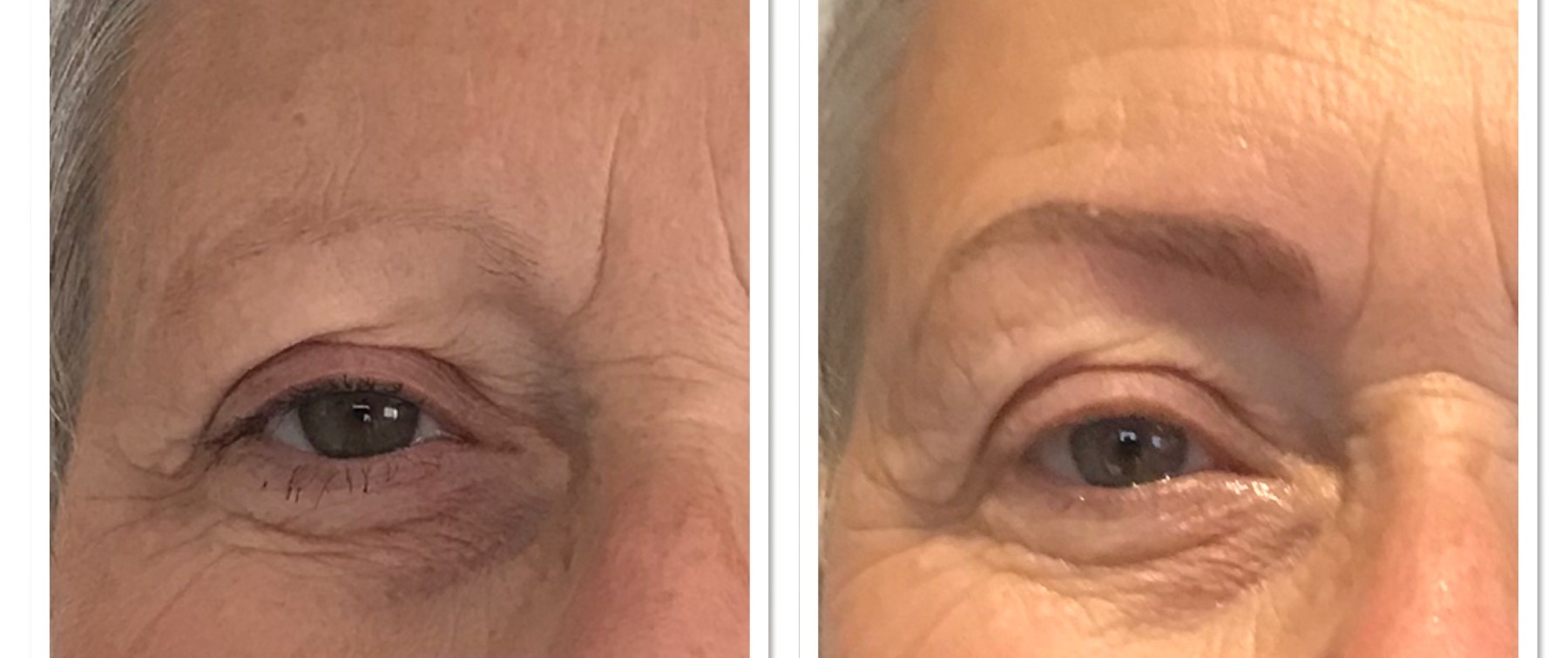 Permanente make-up wenkbrauwen en ogen voor en na, resultaat 2